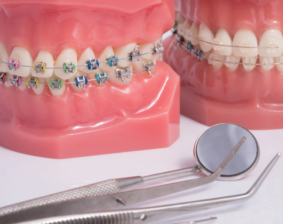 Multi-attache métallique