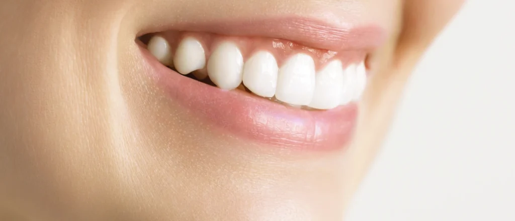 Sourire aux dents bien alignées après un traitement d’orthodontie