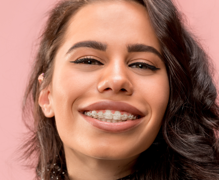 Multi-attache céramique