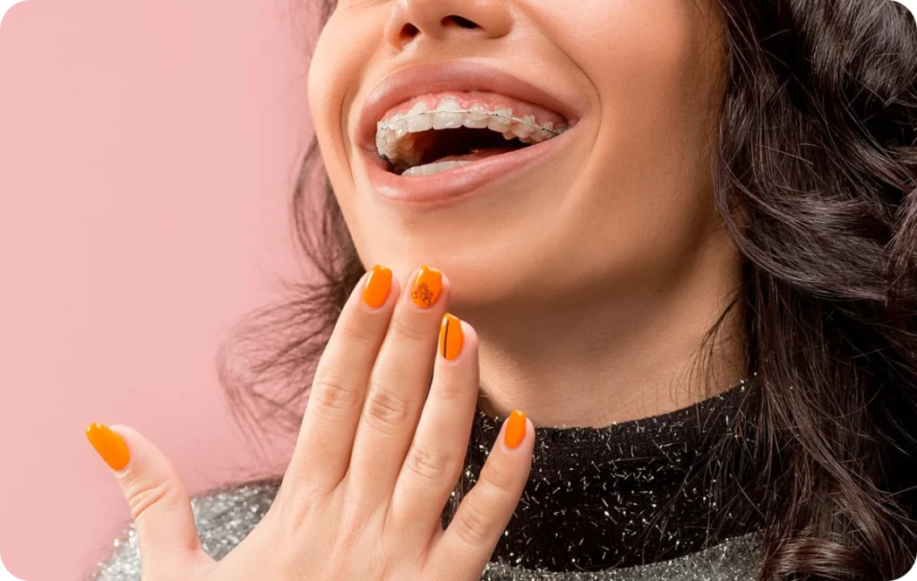 Multi-attache céramique