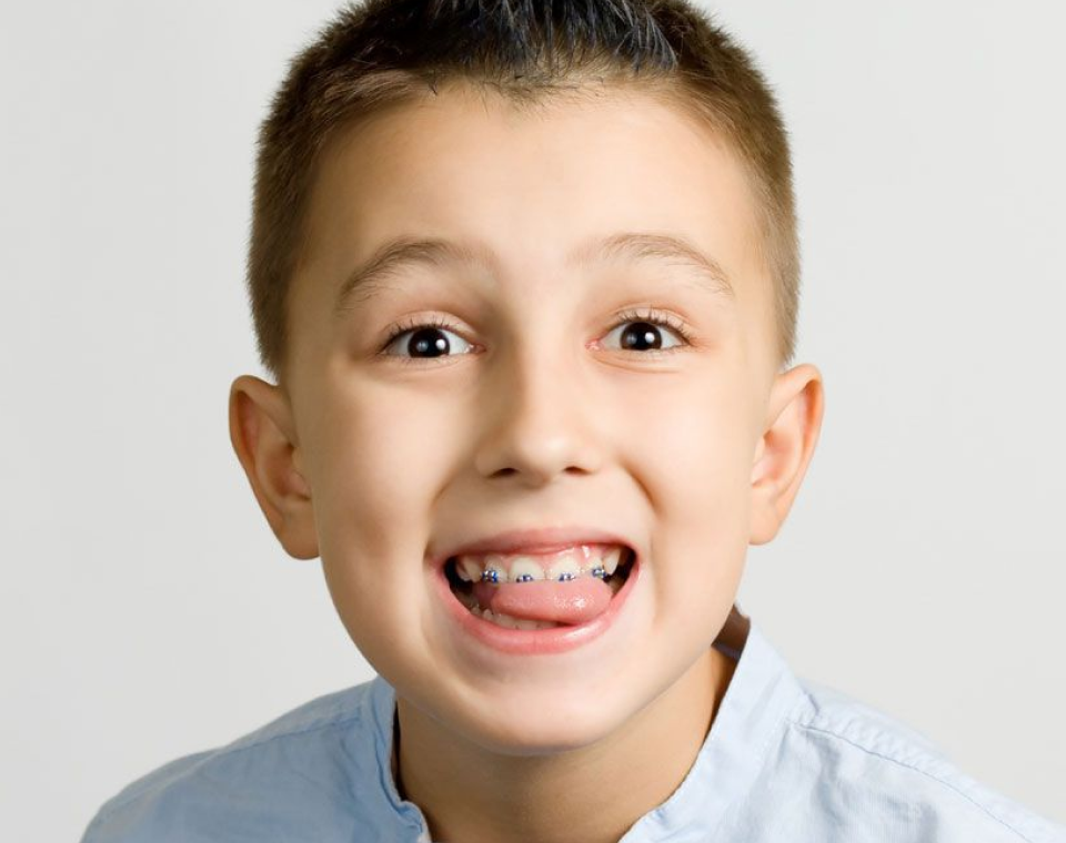 L’orthodontie enfant