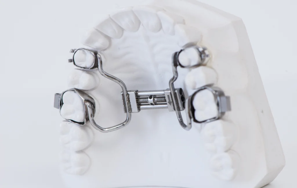 Traitement interceptif